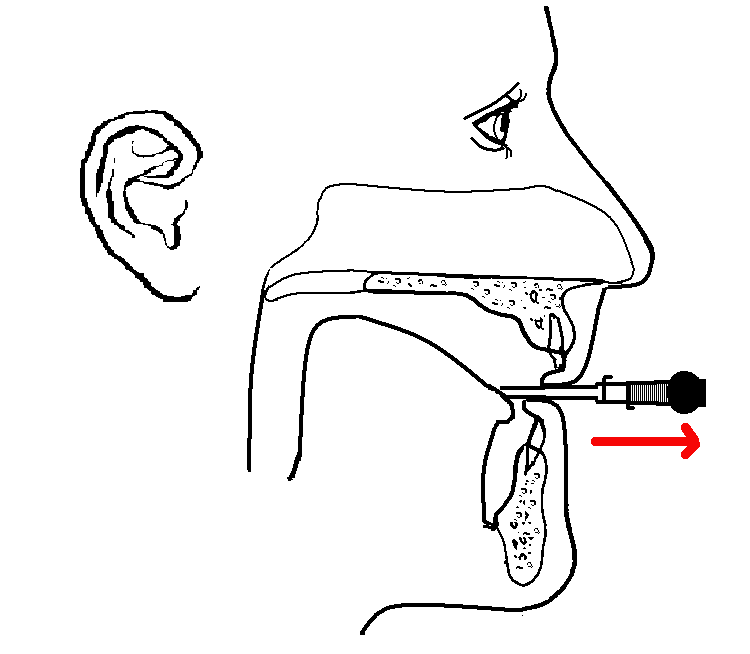 Embouchure piano